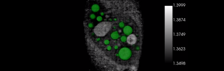 Seeing LLPS (liquid liquid phase separation) with holotomography