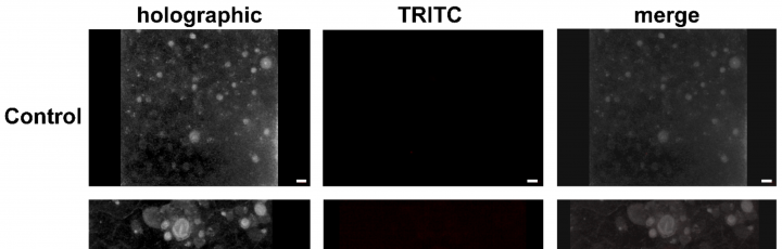Epifluorescenza di PVDF e PLA colorato con rosso Nilo in Aurelia sp. meduse ephyrae acquisite insieme all'olotomogramma.