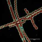 Cylindrospermum enhanced darkfield image